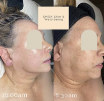 SMÜK Skin & Well-being  Photo
