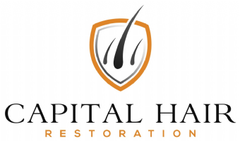 Capital Hair Restoration - Hair Transplant Photo