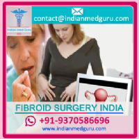 Fibroid Surgery in India Photo